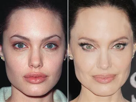 Did Angelina Jolie Get Plastic Surgery? Exploring the Rumors and Realities