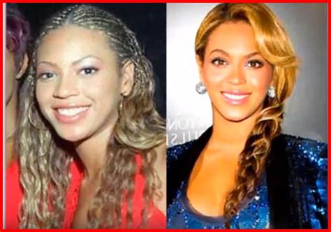 Did Beyonce Have Plastic Surgery? Exploring the Intersection of Celebrity and Cosmetic Enhancements